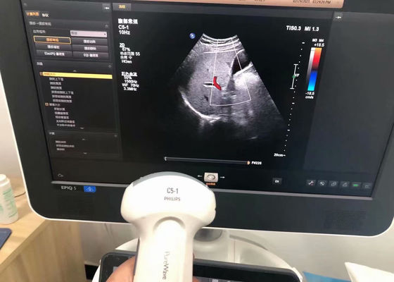 فيليب C5-1 الموجات فوق الصوتية الطبية في البطن لجهاز EPIQ 5