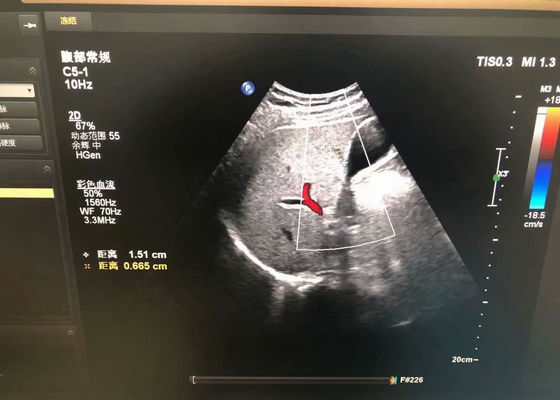 فيليب C5-1 الموجات فوق الصوتية الطبية في البطن لجهاز EPIQ 5